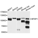 Western Blot - Anti-BFSP1 Antibody (A3764) - Antibodies.com