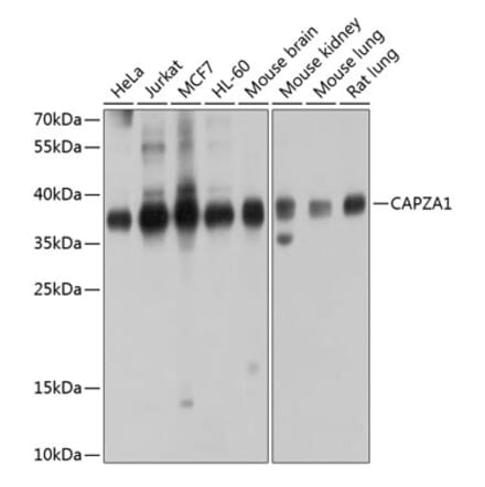 Western Blot - Anti-CAPZA1 Antibody (A14460) - Antibodies.com