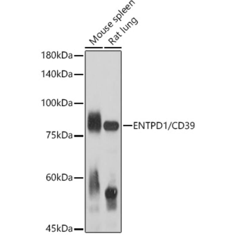 Western Blot - Anti-CD39 Antibody (A14461) - Antibodies.com