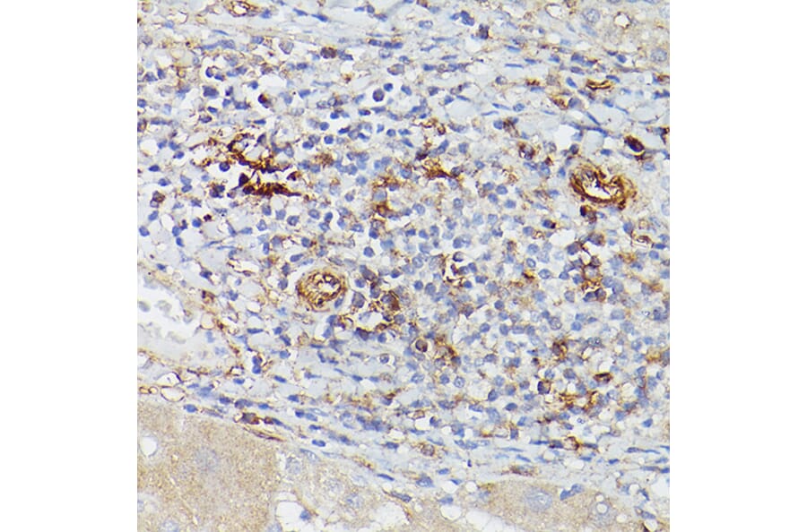 Immunohistochemistry - Anti-CD39 Antibody (A14461) - Antibodies.com
