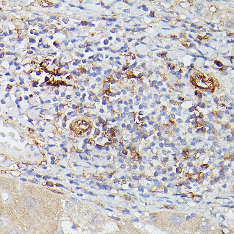 Immunohistochemistry - Anti-CD39 Antibody (A14461) - Antibodies.com