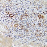 Immunohistochemistry - Anti-CD39 Antibody (A14461) - Antibodies.com