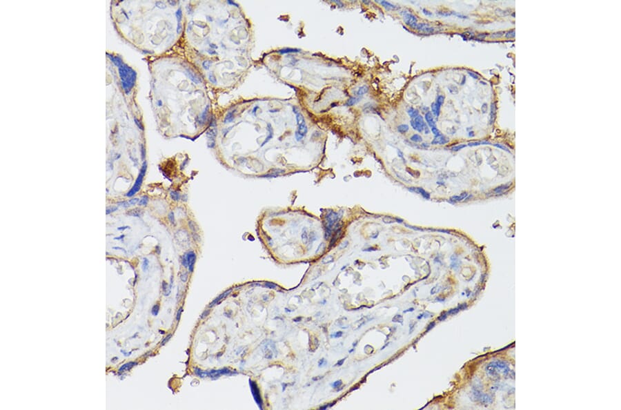 Immunohistochemistry - Anti-CD39 Antibody (A14461) - Antibodies.com