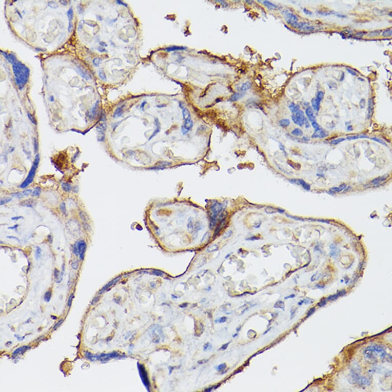 Immunohistochemistry - Anti-CD39 Antibody (A14461) - Antibodies.com