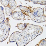 Immunohistochemistry - Anti-CD39 Antibody (A14461) - Antibodies.com