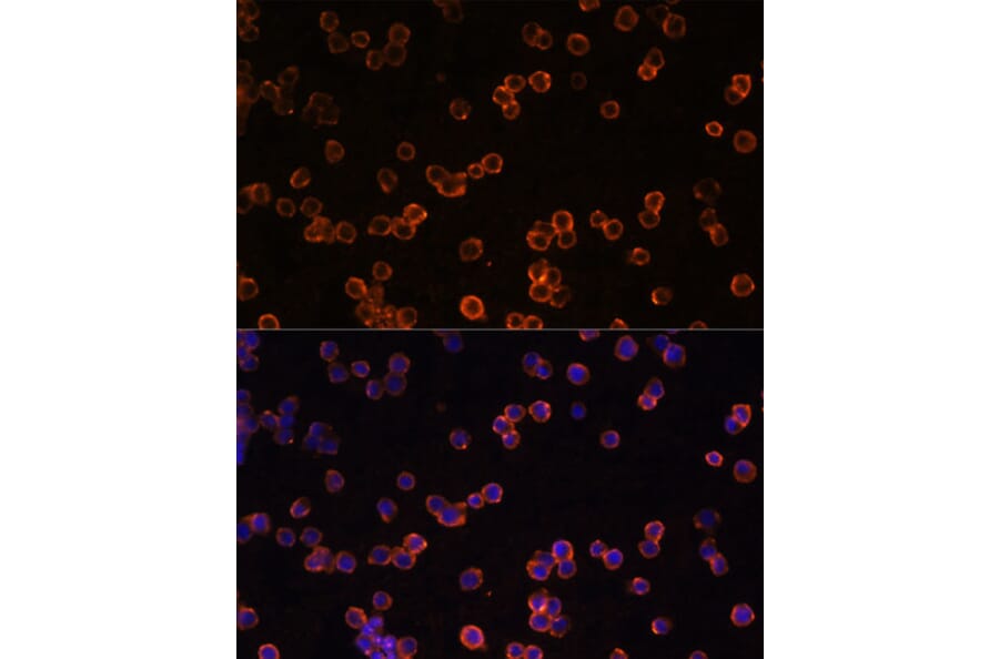 Immunofluorescence - Anti-CD39 Antibody (A14461) - Antibodies.com