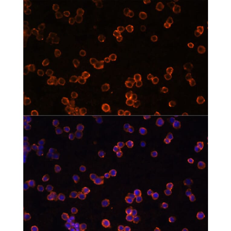 Immunofluorescence - Anti-CD39 Antibody (A14461) - Antibodies.com
