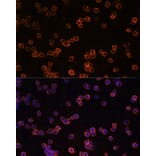 Immunofluorescence - Anti-CD39 Antibody (A14461) - Antibodies.com