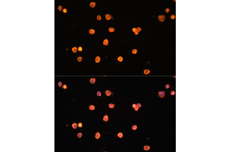 Immunofluorescence - Anti-CD39 Antibody (A14461) - Antibodies.com