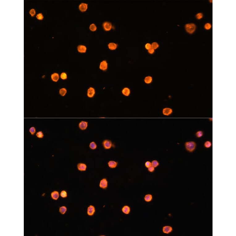 Immunofluorescence - Anti-CD39 Antibody (A14461) - Antibodies.com