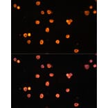 Immunofluorescence - Anti-CD39 Antibody (A14461) - Antibodies.com