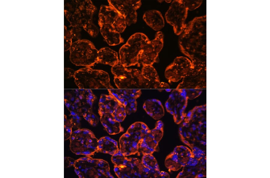 Immunofluorescence - Anti-CD39 Antibody (A14461) - Antibodies.com