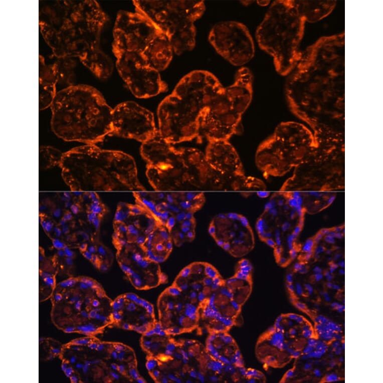 Immunofluorescence - Anti-CD39 Antibody (A14461) - Antibodies.com
