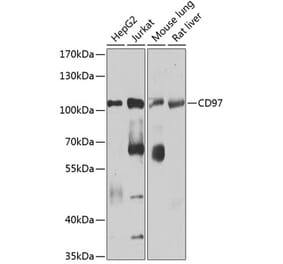 Western Blot - Anti-CD97 Antibody (A14462) - Antibodies.com