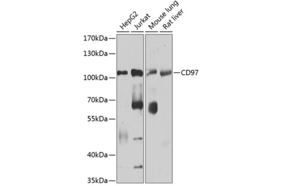 Western Blot - Anti-CD97 Antibody (A14462) - Antibodies.com
