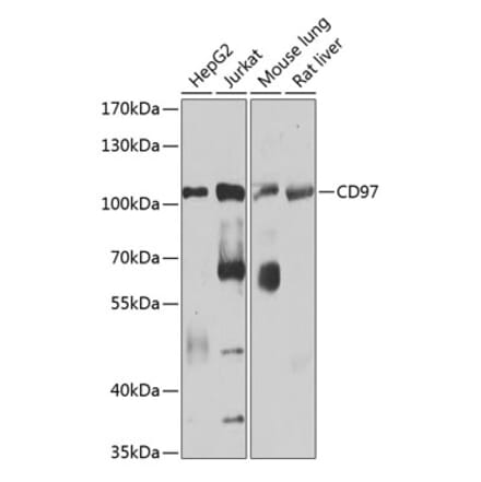 Western Blot - Anti-CD97 Antibody (A14462) - Antibodies.com