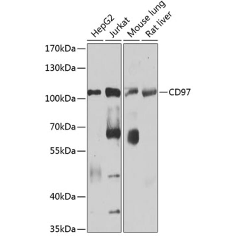Western Blot - Anti-CD97 Antibody (A14462) - Antibodies.com