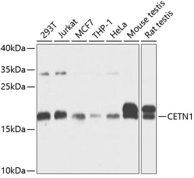 Western blot analysis of extracts of various cell lines, using Anti-CETN1 Antibody (A3784) at 1:1,000 dilution.
Secondary antibody: Goat Anti-Rabbit IgG (H+L) (HRP) (AS014) at 1:10,000 dilution.
Lysates / proteins: 25µg per lane.
Blocking buffer: 3% non-fat dry milk in TBST.
Detection: ECL Basic Kit (RM00020).
Exposure time: 10s.