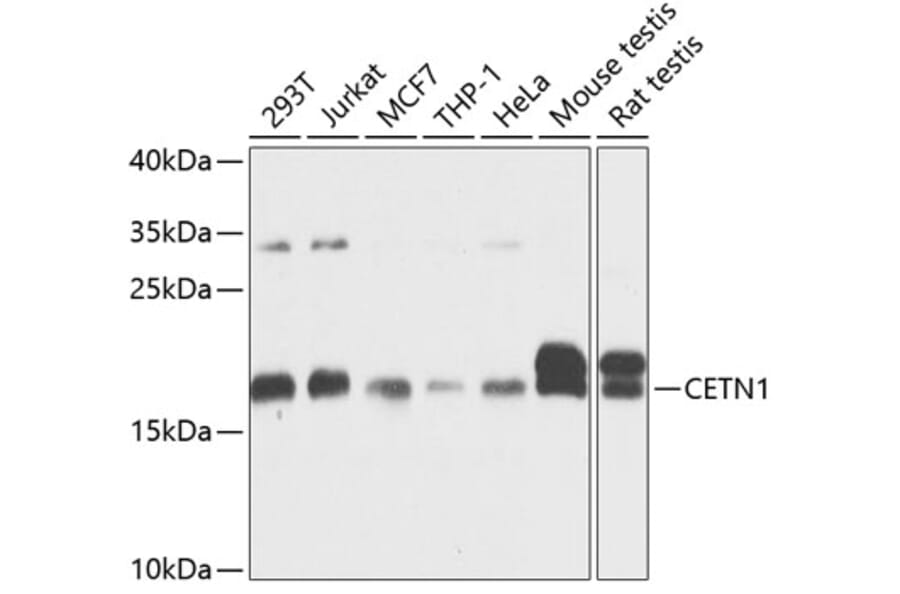 Western Blot - Anti-Centrin 1 Antibody (A14463) - Antibodies.com