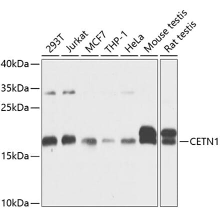 Western Blot - Anti-Centrin 1 Antibody (A14463) - Antibodies.com