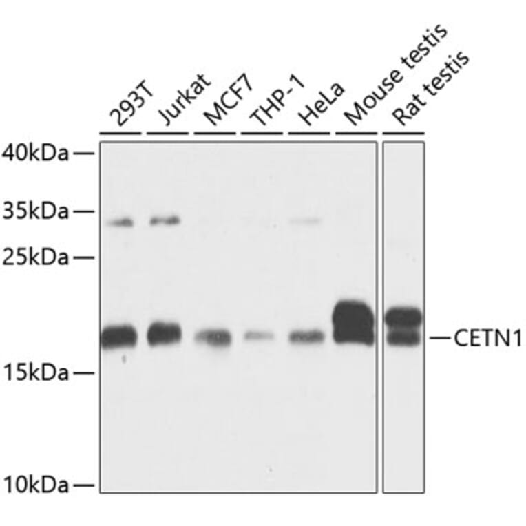 Western Blot - Anti-Centrin 1 Antibody (A14463) - Antibodies.com