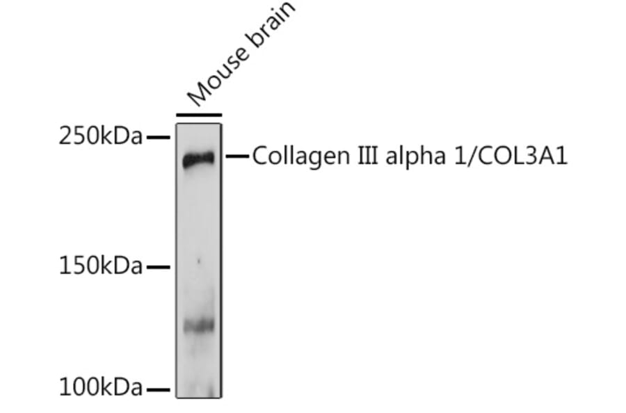 Western Blot - Anti-Collagen III Antibody (A14465) - Antibodies.com