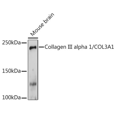 Western Blot - Anti-Collagen III Antibody (A14465) - Antibodies.com
