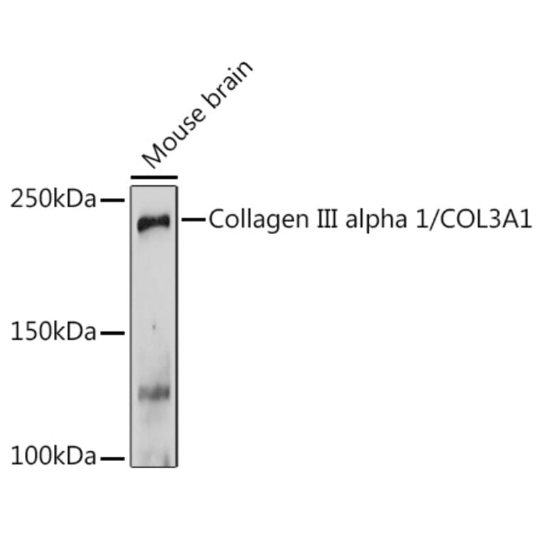 Western Blot - Anti-Collagen III Antibody (A14465) - Antibodies.com