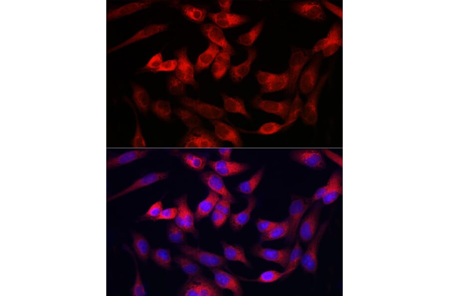 Immunofluorescence - Anti-Collagen III Antibody (A14465) - Antibodies.com