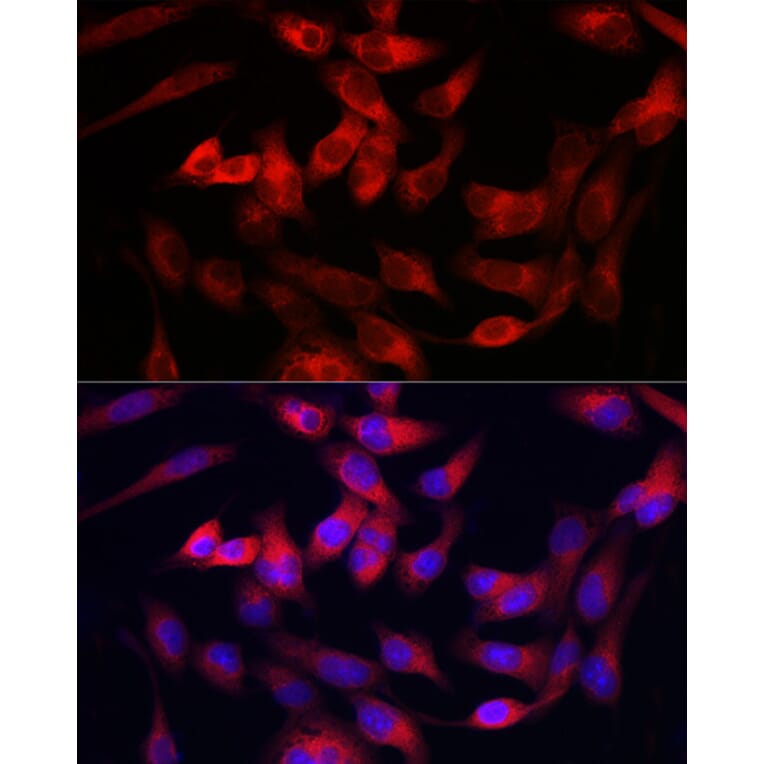 Immunofluorescence - Anti-Collagen III Antibody (A14465) - Antibodies.com