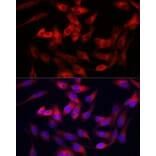 Immunofluorescence - Anti-Collagen III Antibody (A14465) - Antibodies.com