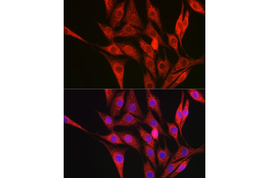 Immunofluorescence - Anti-Collagen III Antibody (A14465) - Antibodies.com
