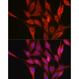 Immunofluorescence - Anti-Collagen III Antibody (A14465) - Antibodies.com