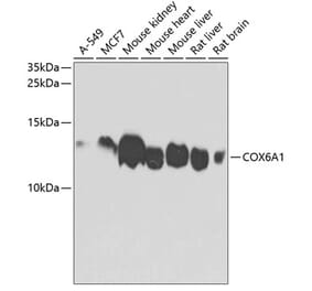 Western Blot - Anti-COX6A1 Antibody (A14466) - Antibodies.com
