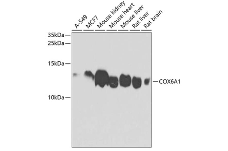 Western Blot - Anti-COX6A1 Antibody (A14466) - Antibodies.com