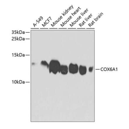Western Blot - Anti-COX6A1 Antibody (A14466) - Antibodies.com