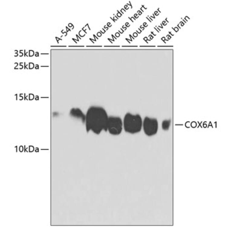 Western Blot - Anti-COX6A1 Antibody (A14466) - Antibodies.com