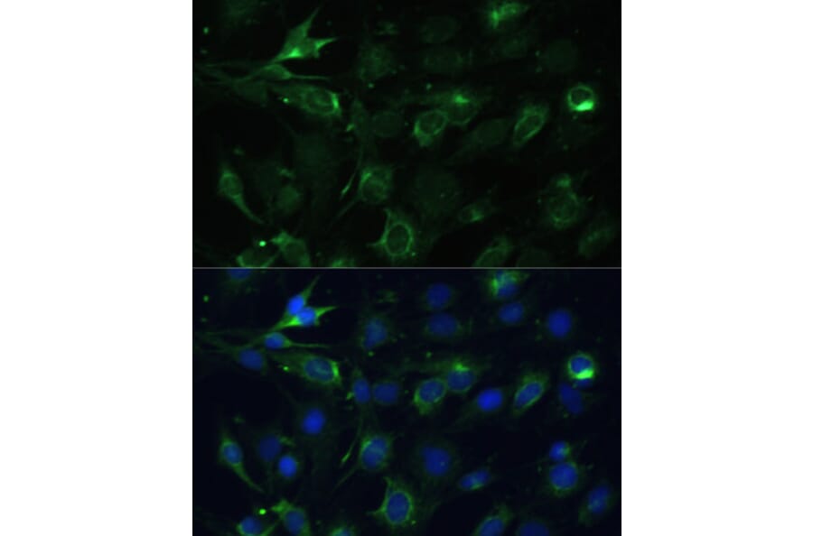 Immunofluorescence - Anti-COX6A1 Antibody (A14466) - Antibodies.com