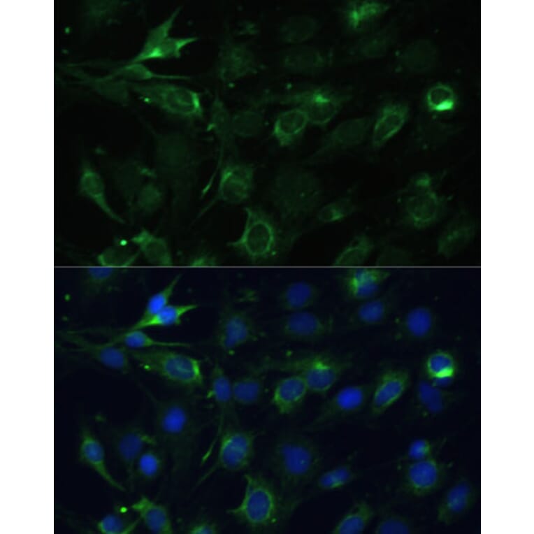 Immunofluorescence - Anti-COX6A1 Antibody (A14466) - Antibodies.com