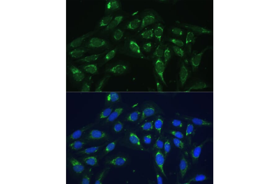 Immunofluorescence - Anti-COX6A1 Antibody (A14466) - Antibodies.com