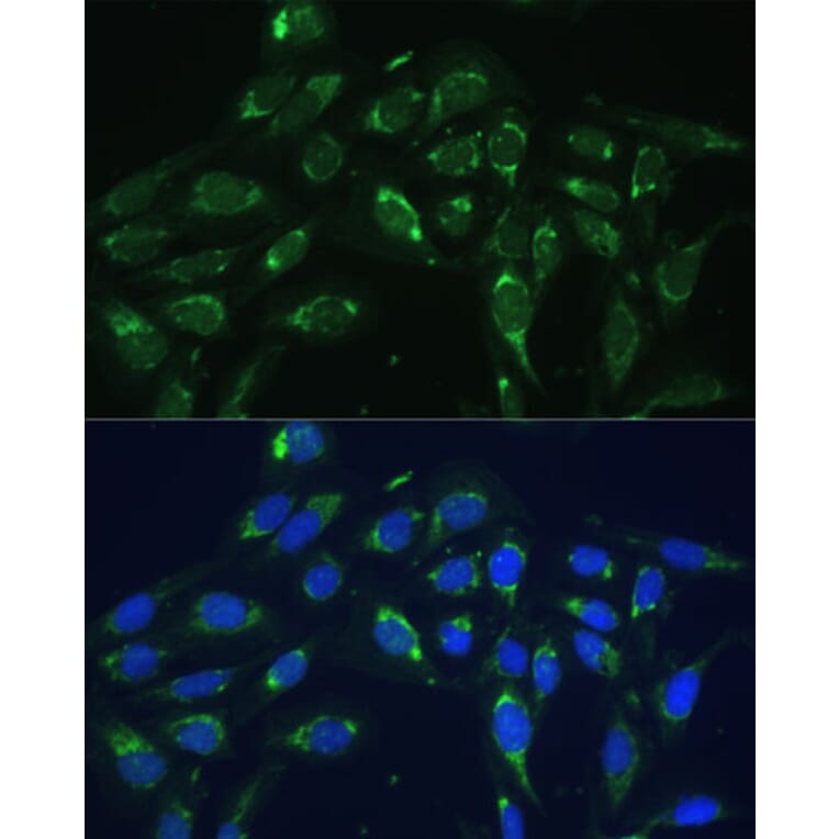 Immunofluorescence - Anti-COX6A1 Antibody (A14466) - Antibodies.com