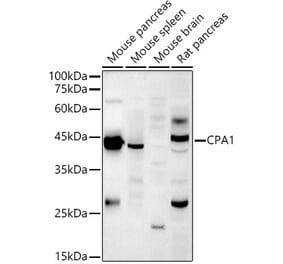 Western Blot - Anti-Carboxypeptidase A Antibody (A14467) - Antibodies.com