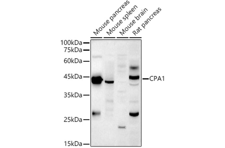 Western Blot - Anti-Carboxypeptidase A Antibody (A14467) - Antibodies.com