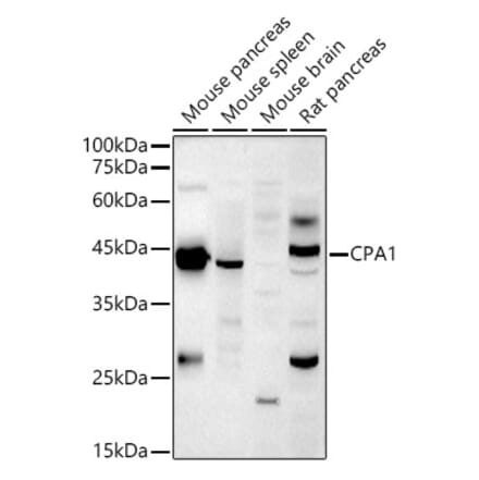 Western Blot - Anti-Carboxypeptidase A Antibody (A14467) - Antibodies.com