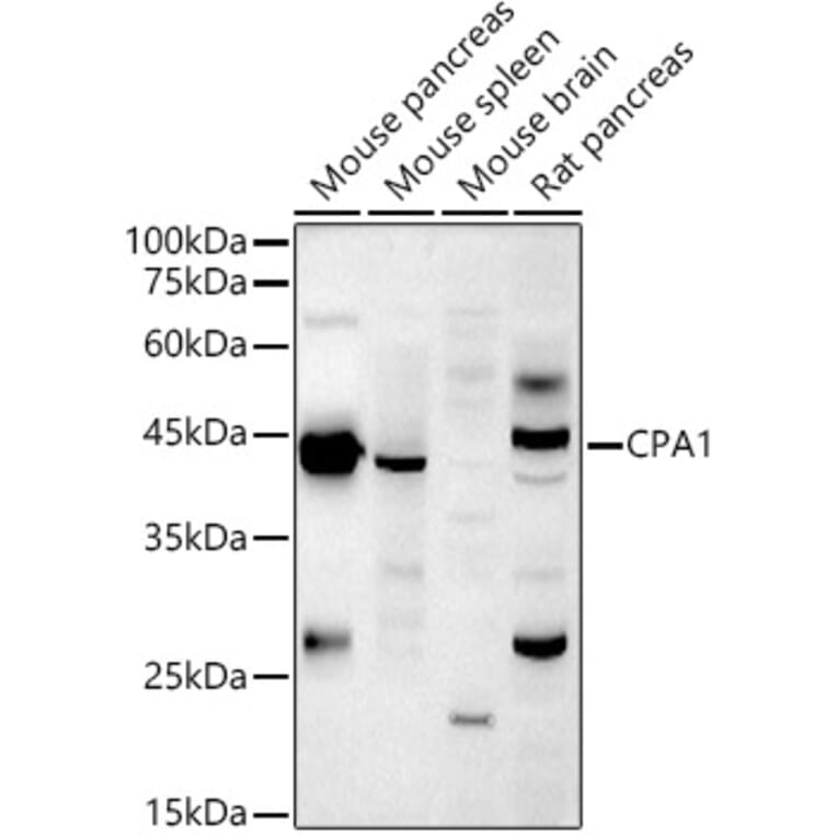 Western Blot - Anti-Carboxypeptidase A Antibody (A14467) - Antibodies.com