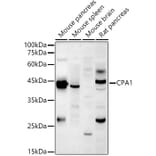 Western Blot - Anti-Carboxypeptidase A Antibody (A14467) - Antibodies.com