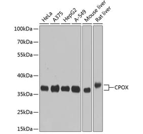 Western Blot - Anti-CPOX Antibody (A14468) - Antibodies.com