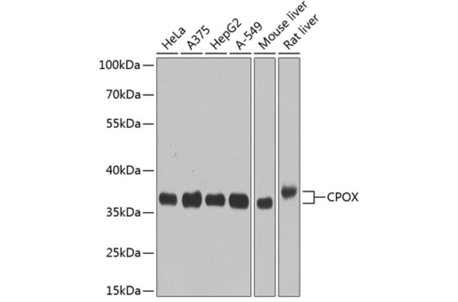 Western Blot - Anti-CPOX Antibody (A14468) - Antibodies.com