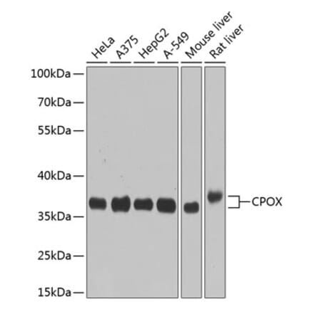 Western Blot - Anti-CPOX Antibody (A14468) - Antibodies.com