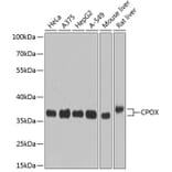 Western Blot - Anti-CPOX Antibody (A14468) - Antibodies.com